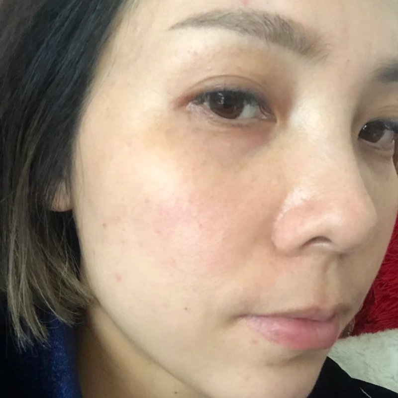 Dull & Tired Skin Recovery — common symptoms