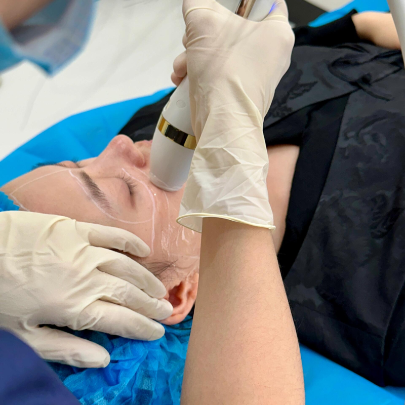 Pigmentation & Melasma — treatment goal