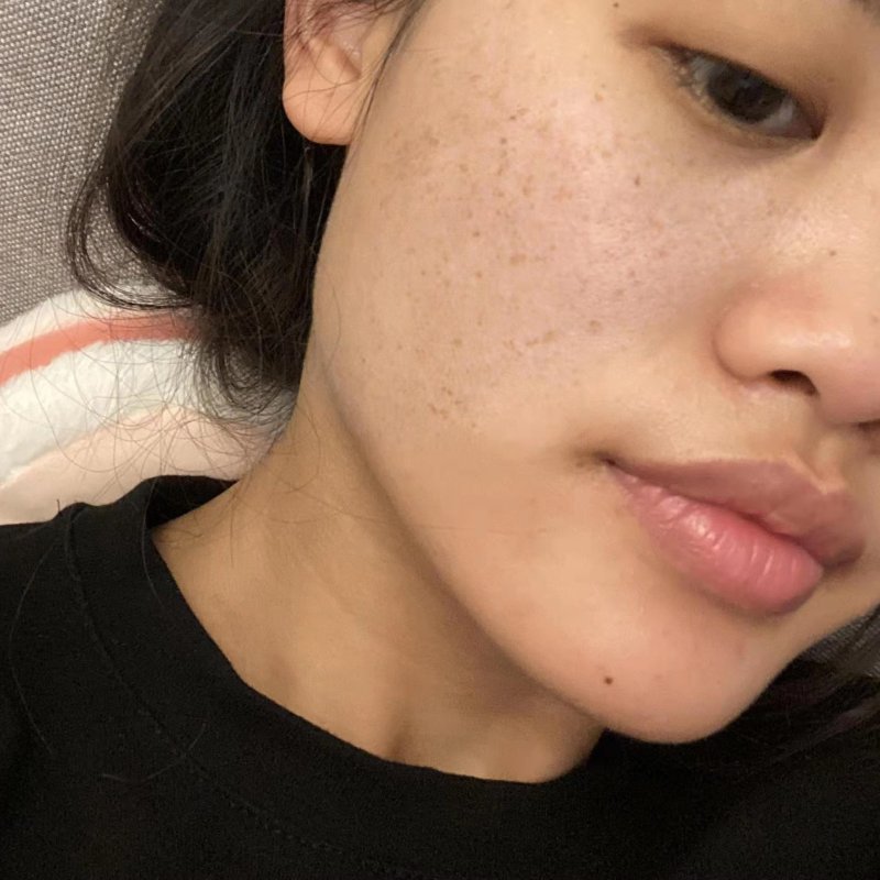 Radiance Booster Facial — common symptoms
