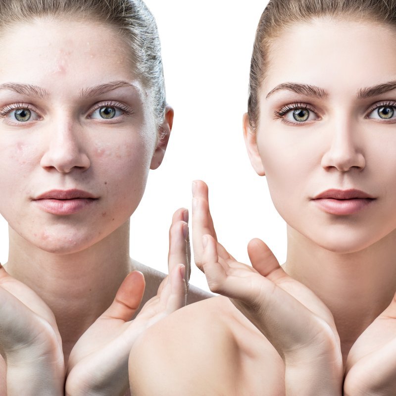 Radiance Booster Facial — treatment goal