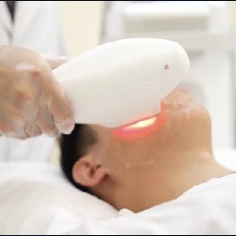 Texture & Pore Refinement — treatment goal